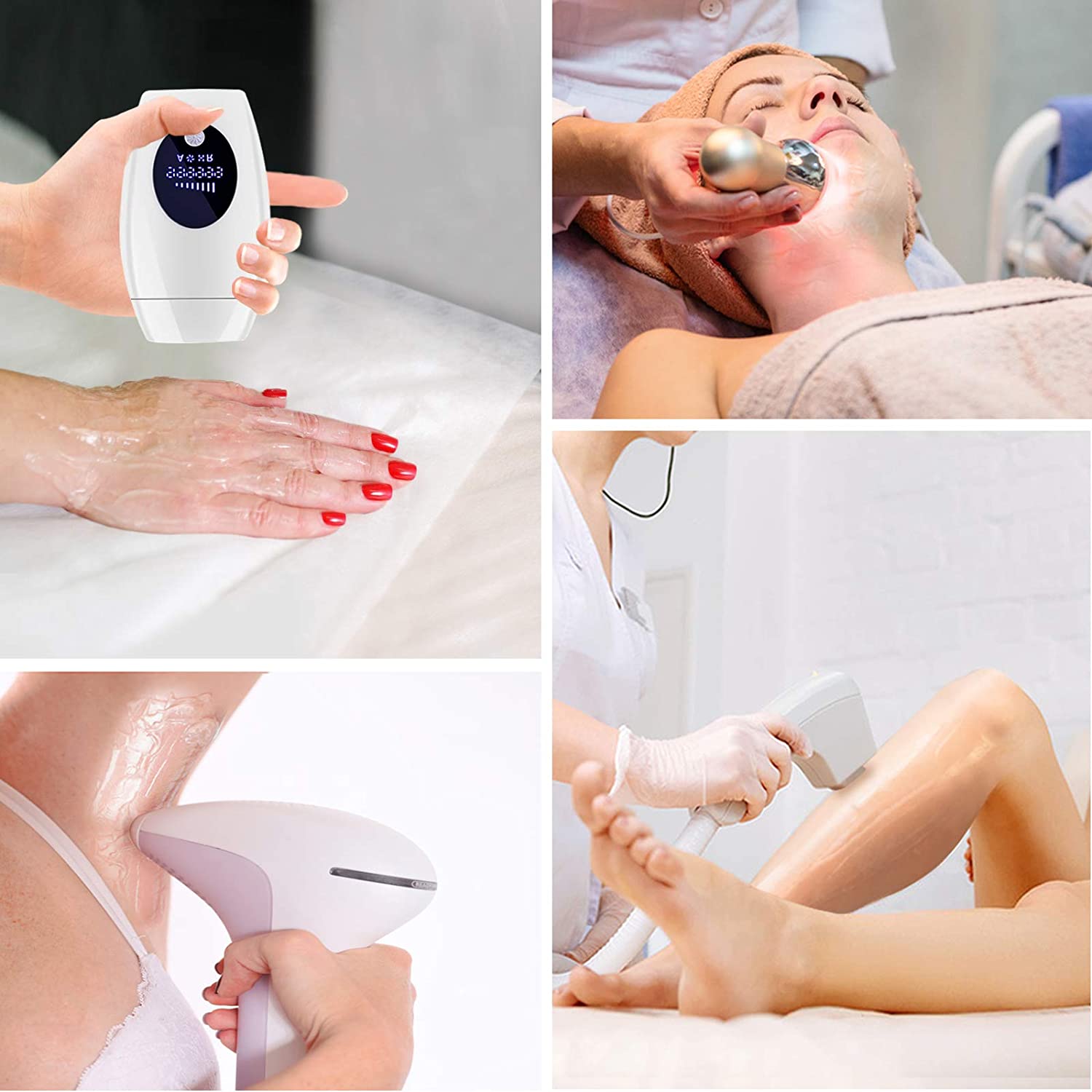 Laser hair removal5